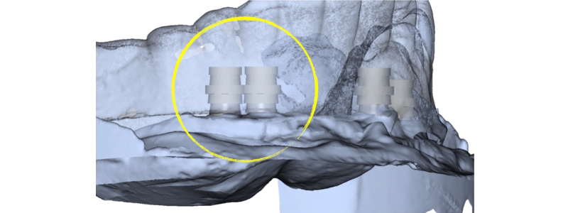 Where Is the Line With Locators? Benting where is line locators 05 2