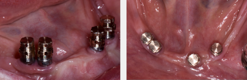 Where Is the Line With Locators? Benting where is line locators 06 1