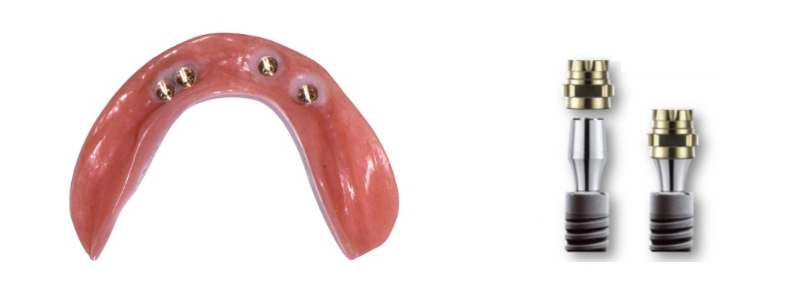 Where Is the Line With Locators? Benting where is line locators 07