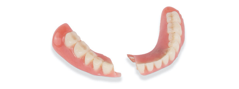 Oh Snap! Managing a Fractured Denture Base Dichter managing fractured denture base 01