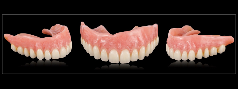 Oh Snap! Managing a Fractured Denture Base Dichter managing fractured denture base 05