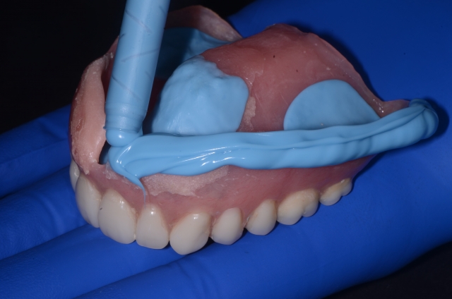 salcetti 8 considerations denture relining 03 1