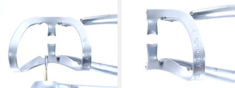 Use a 212 Modified Clamp to Restore Cervical Carious & NCCLs on Adjacent Teeth Guerrero using 212 modified clamp 01 1