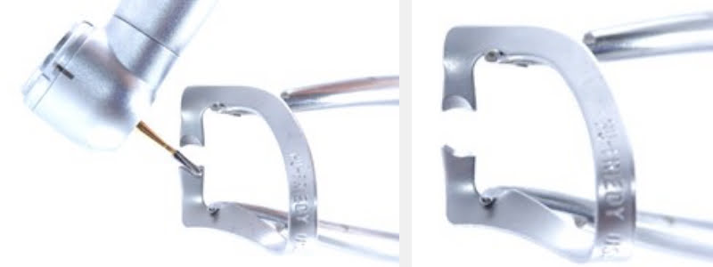 Use a 212 Modified Clamp to Restore Cervical Carious & NCCLs on Adjacent Teeth Guerrero using 212 modified clamp 02