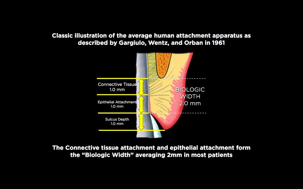 Spear comprehensive guide biologic width 01 1