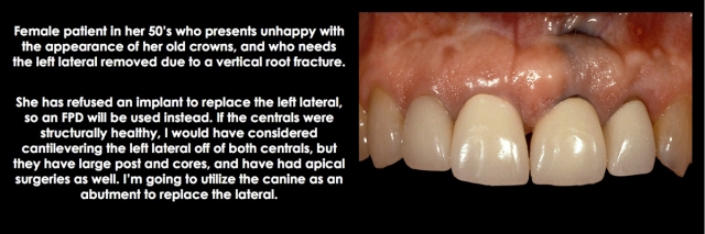 Spear comprehensive guide biologic width 24