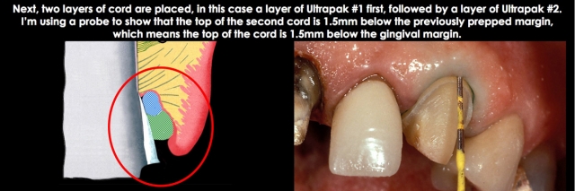 Spear comprehensive guide biologic width 26