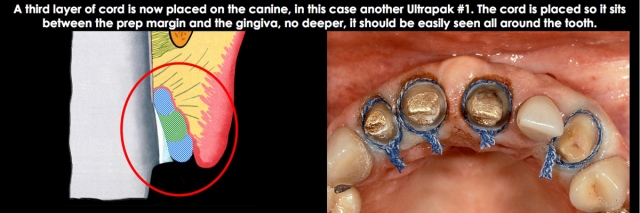 Spear comprehensive guide biologic width 28 1