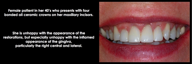 Spear comprehensive guide biologic width 34 1
