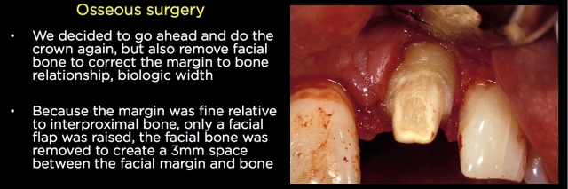 Spear comprehensive guide biologic width 41