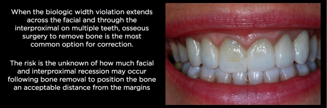 Spear comprehensive guide biologic width 52