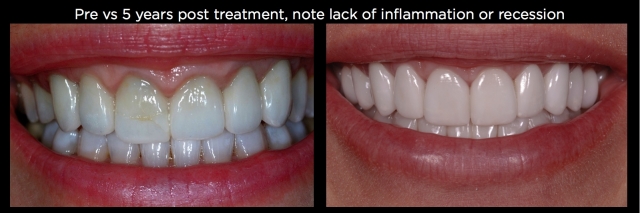 Spear comprehensive guide biologic width 59 1