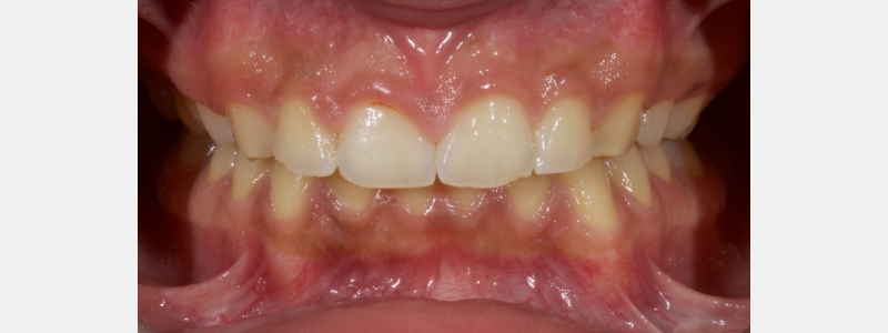 Smithson Planning class iv workhorse pt1 03 1