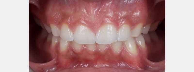 Smithson Planning class iv workhorse pt1 04 1