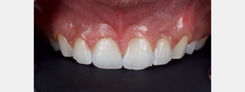 Smithson Planning class iv workhorse pt1 05 1