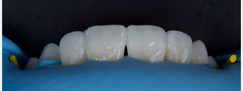 Smithson Planning class iv workhorse pt1 10