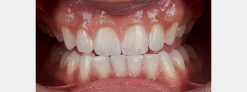 Smithson Planning class iv workhorse pt1 11