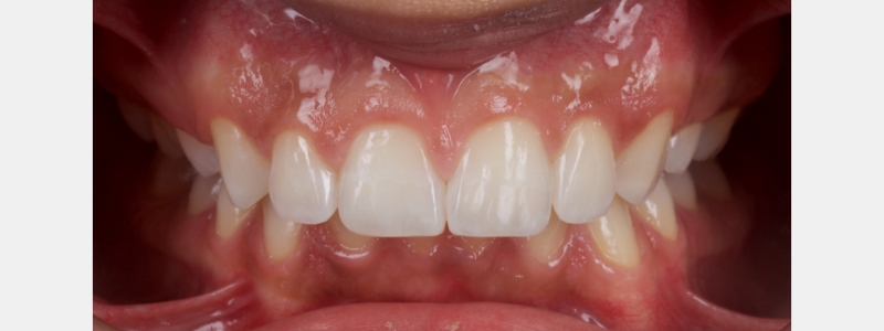 Smithson Planning class iv workhorse pt1 13