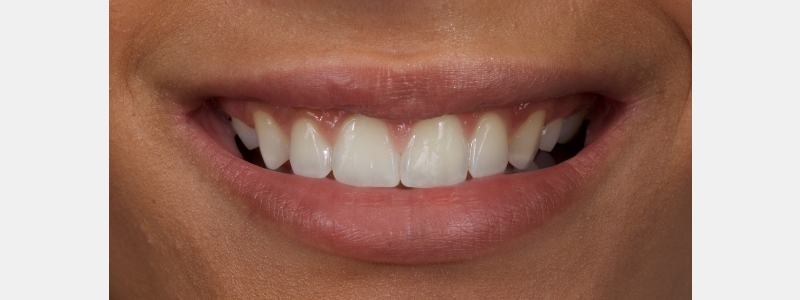 Smithson Planning class iv workhorse pt1 14