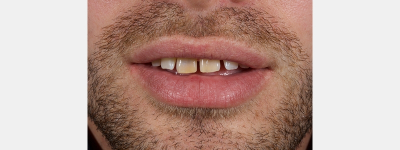 Smithson Planning class iv workhorse pt1 23