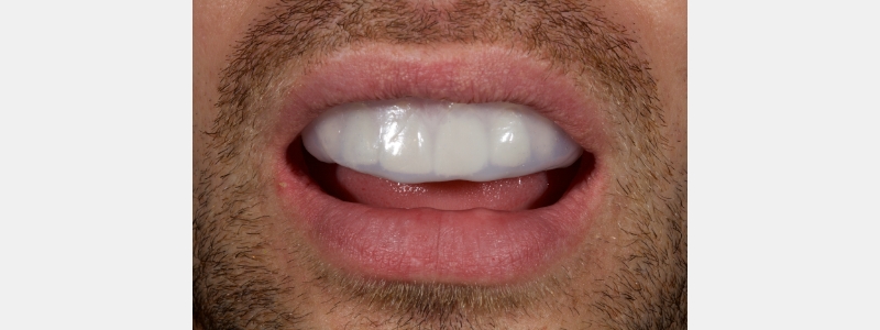 Smithson Planning class iv workhorse pt1 24