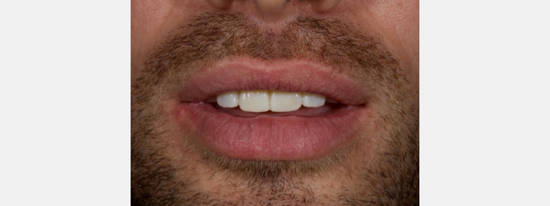 Smithson Planning class iv workhorse pt1 25