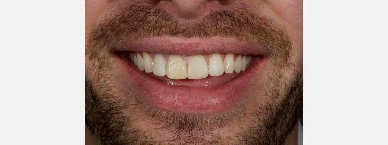 Smithson Planning class iv workhorse pt1 26