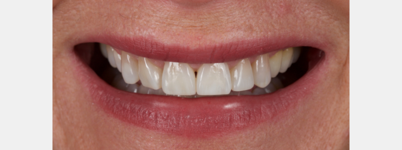 smithson planning class iv part3 04