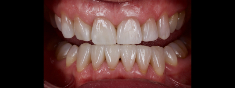 smithson planning class iv part3 05