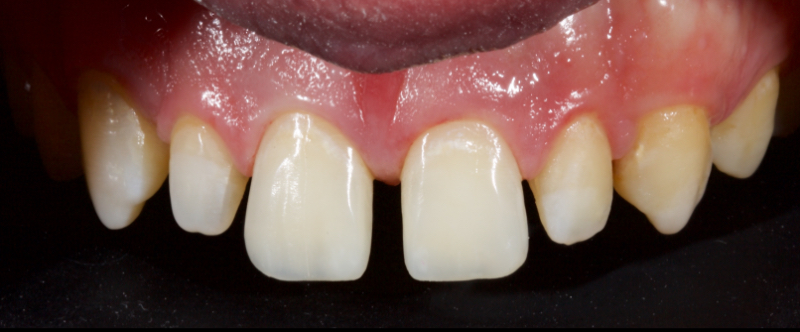 smithson planning class iv part3 29