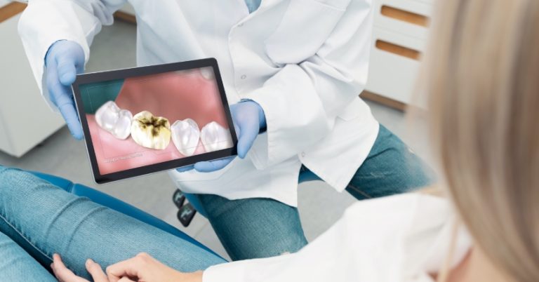 PFM or Zirconia Crown? A Patient’s Question and Concerns