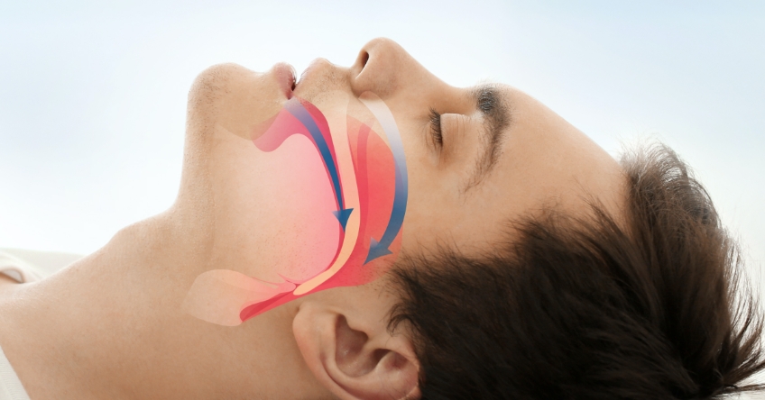Advanced FGTP: The Inclusion of Airway Prosthodontics JeffreyRouse advanced fgtp airway prosthodontics Fig.3