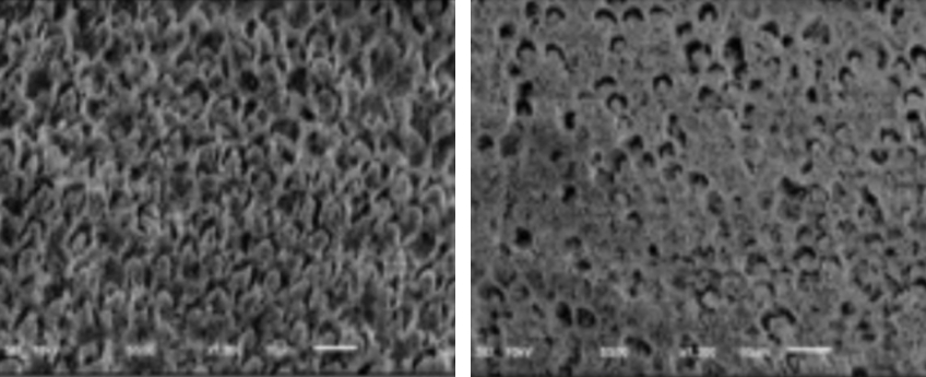 Three Keys to Ceramic Dental Adhesion: Enamel, Dentin, and Cementum Variations Bonk three keys ceramic dental adhesion 03