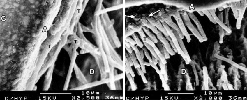 Three Keys to Ceramic Dental Adhesion: Enamel, Dentin, and Cementum Variations Bonk three keys ceramic dental adhesion 04