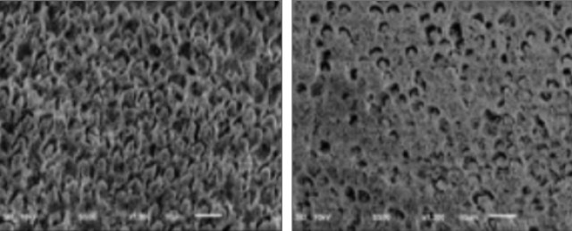 Three Keys to Ceramic Dental Adhesion: Enamel, Dentin, and Cementum Variations