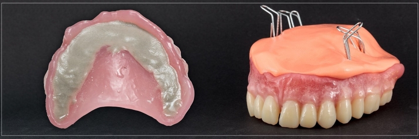 Clinical Remount Procedure: A Visual Guide DarinDichter ClinicaRemountProcd Fig.4