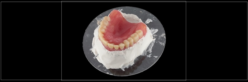 Clinical Remount Procedure: A Visual Guide DarinDichter ClinicaRemountProcd Fig.7