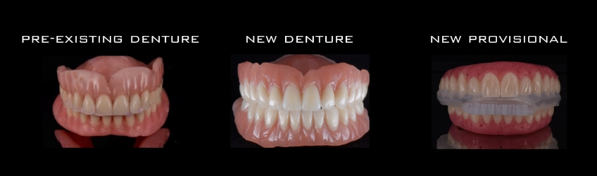 Four Key Elements of Esthetic Dentistry and the Importance of the Prototype Mitrani four key elements esthetic 01 1