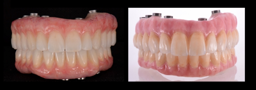 Four Key Elements of Esthetic Dentistry and the Importance of the Prototype Mitrani four key elements esthetic 02
