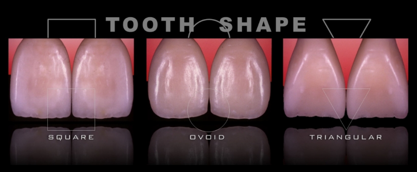 Four Key Elements of Esthetic Dentistry and the Importance of the Prototype Mitrani four key elements esthetic 04