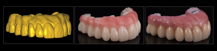 Four Key Elements of Esthetic Dentistry and the Importance of the Prototype Mitrani four key elements esthetic 11