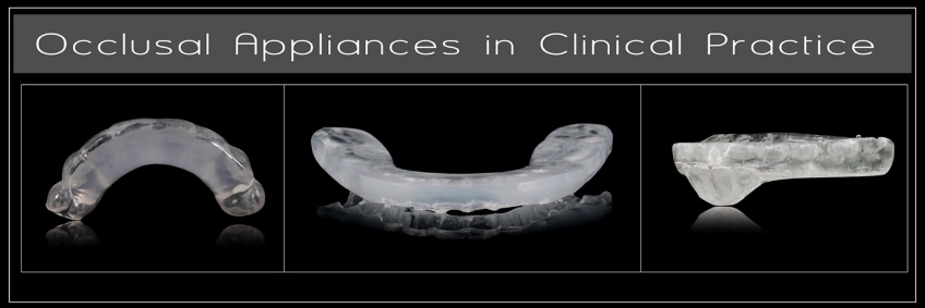 A Digital Approach to Occlusal Appliance Fabrication Dichter digital approach occlusal appliance 01