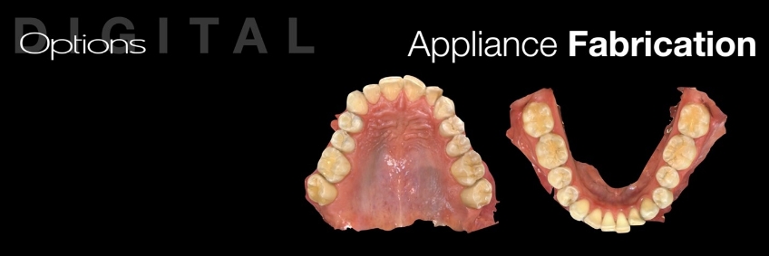 A Digital Approach to Occlusal Appliance Fabrication Dichter digital approach occlusal appliance 03
