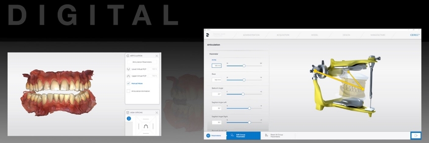 A Digital Approach to Occlusal Appliance Fabrication Dichter digital approach occlusal appliance 08