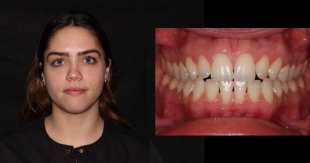 Dental Photography 101