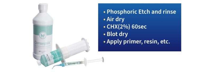 Benefits of Chlorhexidine in the Adhesion Process