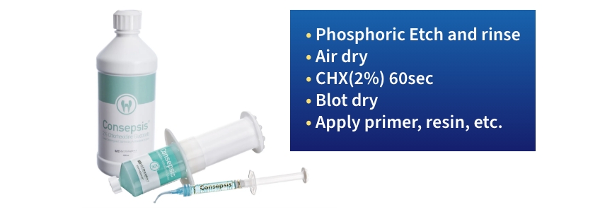 Benefits of Chlorhexidine in the Adhesion Process Bonk benefits of chlorohexidine 01 1