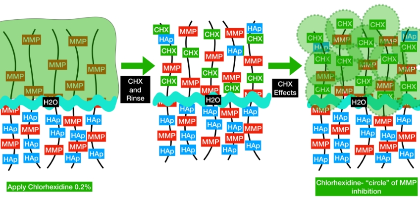 Bonk benefits of chlorohexidine 04