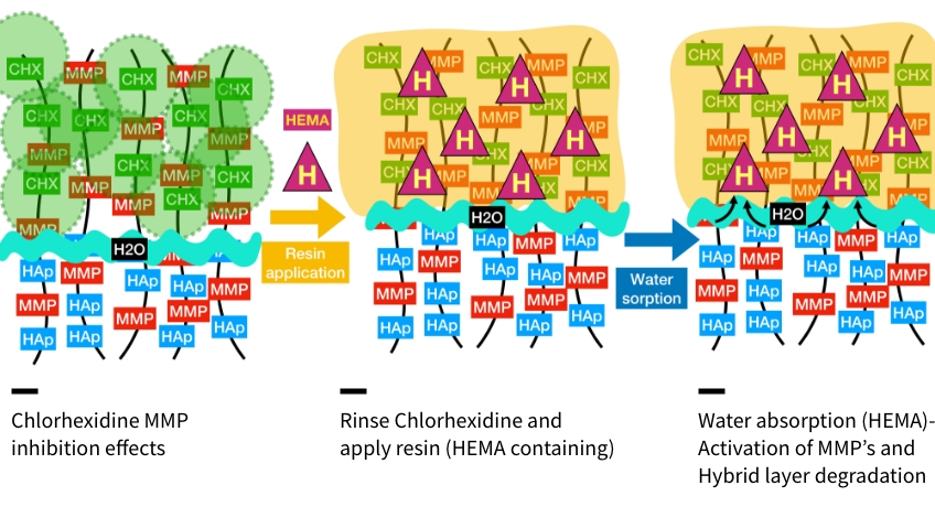 Bonk benefits of chlorohexidine 05