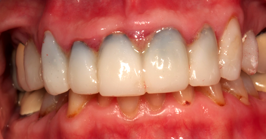 Black Bugs Under Margins? DT073013 Black Bugs